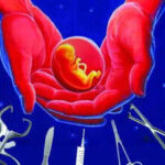 complex surgery during pregnancy saves mother and child https://jaipur.visitinrajasthan.com/wp-content/uploads/2023/10/cropped-cropped-R-2.png