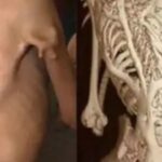 extremely rare fop disease detected in jaisalmer rajasthan for 1st time https://jaipur.visitinrajasthan.com/wp-content/uploads/2023/10/cropped-cropped-R-2.png